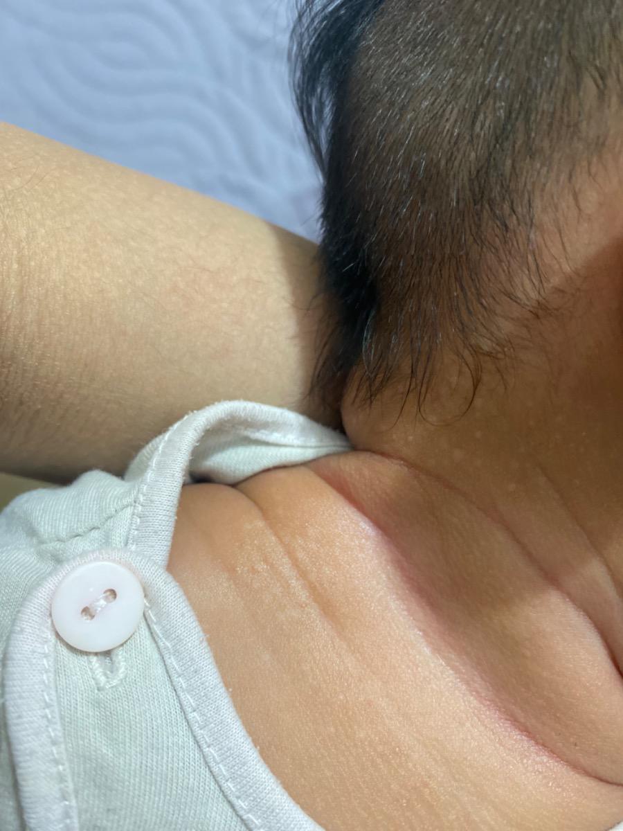 Da con e nổi những vết trắng tròn như này có sao không ạ