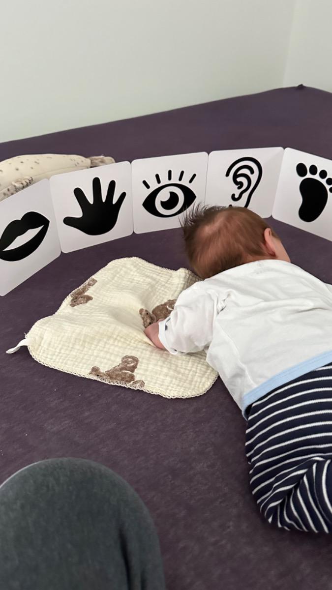 bé nhà mình 3 tháng, phía sau đầu có 1 vành trắng như vành khăn. Cho mình hỏi bé mình có bị còi xương k? 
p/s: bé mình có uóng Vit D mỗi ngày, có bổ sung Vit K theo liều lượng của bs, bé con lai nên màu tóc nhạt nâu, mình có cho bé nằm gối chống bẹp, đó có phải 1 phần nguyên nhân k?