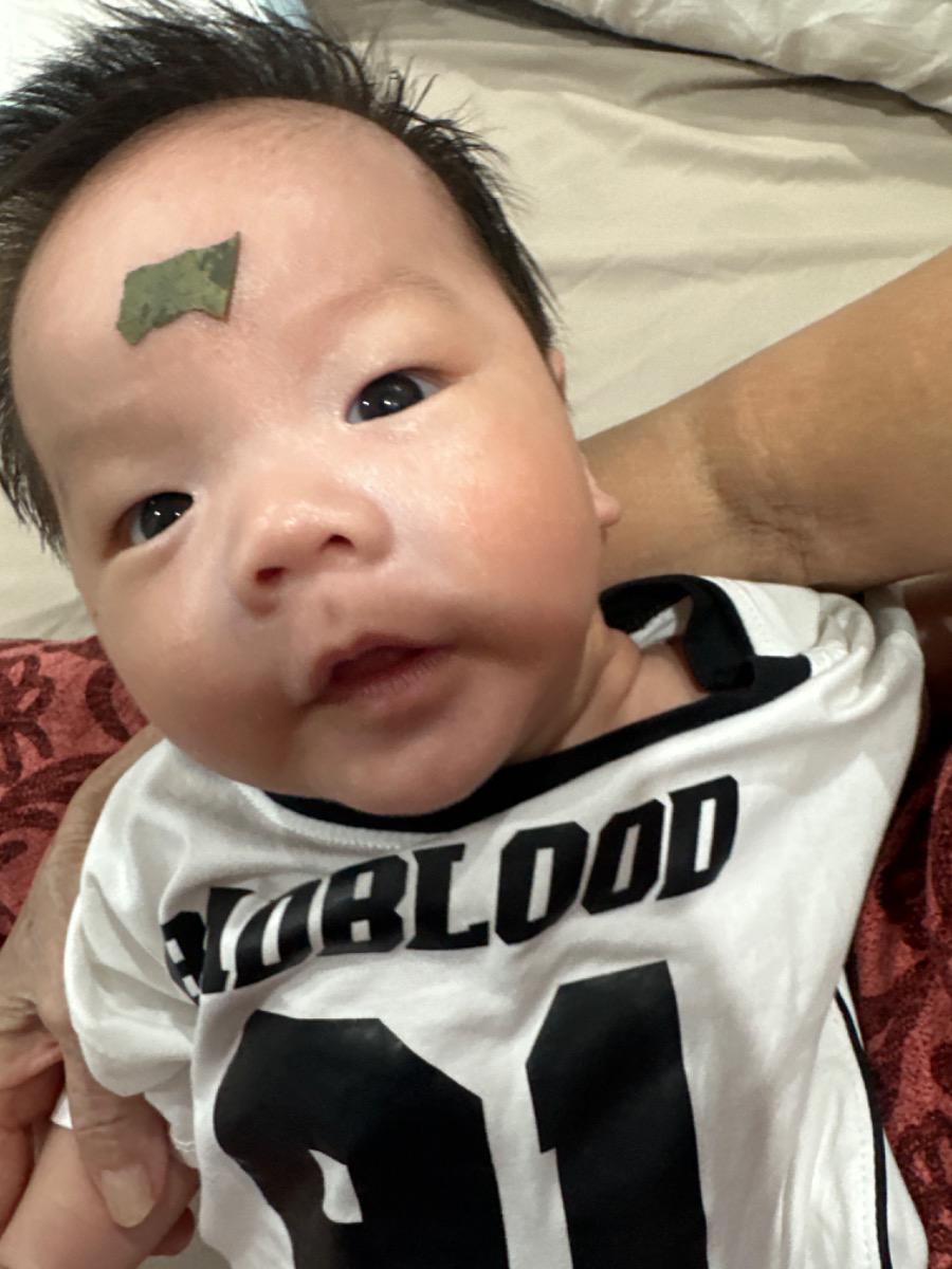 Da em bé 7 tuần tuổi , da em bị chàm màu đỏ sờ vào thô ráp và sần sùi thì nên bôi gì cho bé . Chân bé cũng mọc mụn liti không có nước, chỉ dạng hạt rôm không màu nhưng sờ vào cảm nhận được , ngày một nhiều và dày đặc thì nên bôi gì ạ. M có bôi 2 sp này mà thấy k đỡ