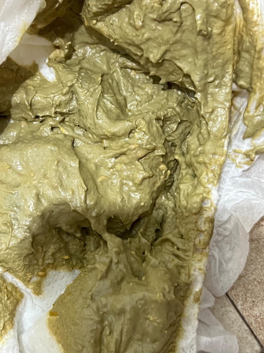 Bé nhà mình hơn 1 tuần nay đi phân xanh, có bọt, nhớt. 2 ngày bé đi 1 lần
Trước giờ bé đi phân vàng, đẹp. Từ khi sinh, Bé uống sct là chủ yếu, sữa mẹ gộp lại 1 ngày đủ ăn 1 cữ
Bsi cho m hỏi như thế là bé đang gặp vấn đề gì vậy ạ