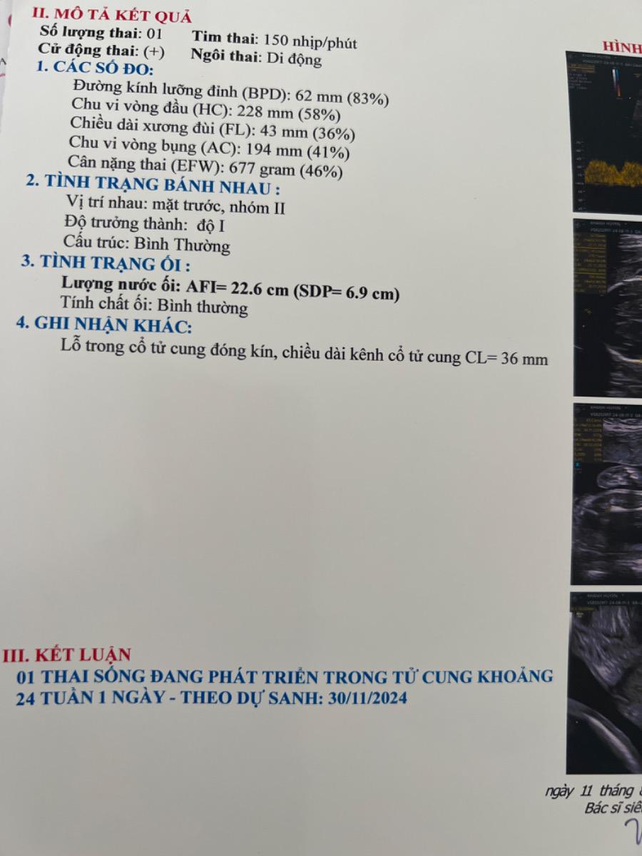 Bác sĩ ơi, hôm nay mình đi khám thai em bé được 24 tuần 1 ngày. Mà mình bị dư nước ối. Lượng nước ối ở tuần 24 tuần 1 ngày của mình là: AFI=22.6cm(SDP=6,9cm) . Bác sĩ báo lượng nước ối của mình dư nhiều. Nên sẽ rất nguy hiểm, mình phải làm sao ạ, bác sĩ khám chỉ nói mình kiêng uống nước dừa nước mía lại. Cho mình xin lời khuyên mình phải làm sao để cân bằng lại nước ối ạ
