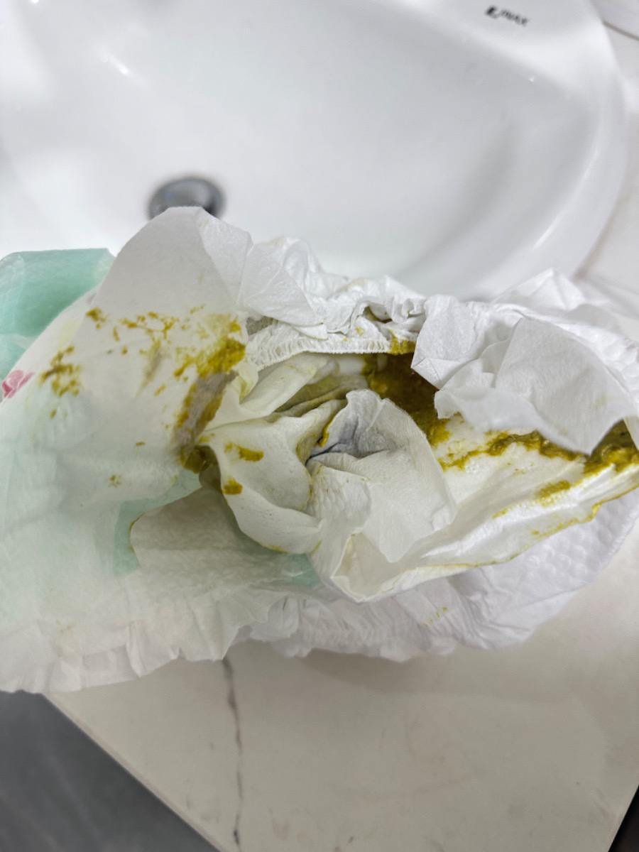 Bé mỗi ngày đi 1 lần nhưng hôm nay bé đi ngoài có phân màu xanh lá thì có sao không bác sĩ. Bé cần tới bệnh viện khám không. Trước đó bé 2 ngày không đi ngoài nên mẹ có cho bé uống men tiêu hoá Bio Gaia