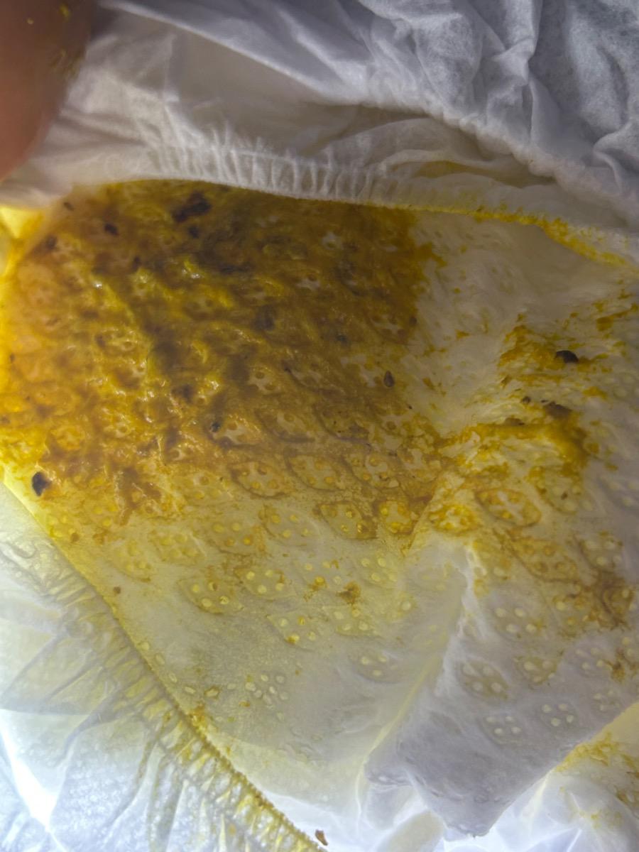 bé 1 tháng 19 ngày bú sữa mẹ hoàn toàn đi phân như thế này có bình thường k ạ, với bé hay bị són phân