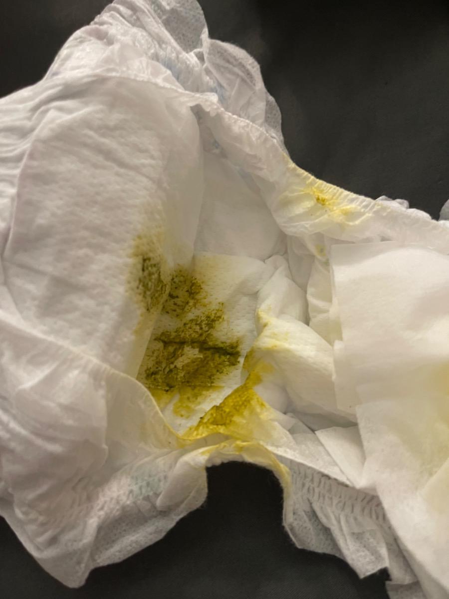 Bé em dc 1 tháng tuổi, dùng sữa mẹ, ngày bú 7 cữ, hiện khoảng 4 kg, hiện bé đi phân lỏng đã 4,5 ngày , trước đó em ăn chay em nghĩ do vậy nên bé dễ đi phân lỏng , tuy nhiên em chuyển qua ăn bt bé vẫn đi ngoài phân lỏng, em ko biết rõ nguyên nhân ạ, nhờ tư vấn giúp e ạ