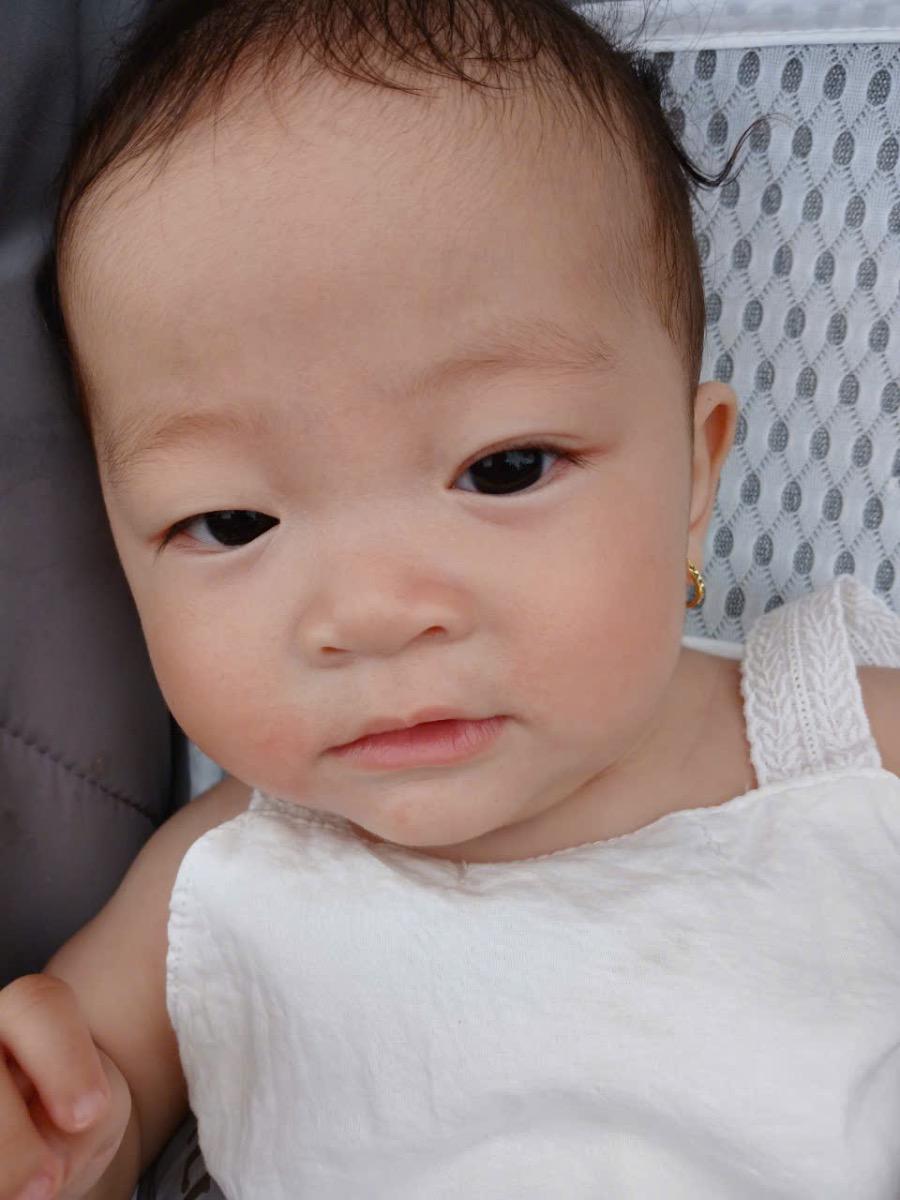 Chào mamibabi,
Xin tư vấn giúp mình, bé nhà mình hiện nay trên mặt đang nổi lấm tấm vài hạt nhỏ hơi đo đỏ như hình hai bên má, mình thắc mắc có phải bé bị chàm hay bị dị ứng thức ăn.
Trưa nay mình cho bé ăn cháo mix với hạt sen, bắp mỹ và bí đao vào lúc 11h, đến khoảng 3h thì thấy mặt của bé bị như vầy.
Mình có thuốc hoặc kem nào điều trị ko ạ? Xin tư vấn giúp mình. Cảm ơn.