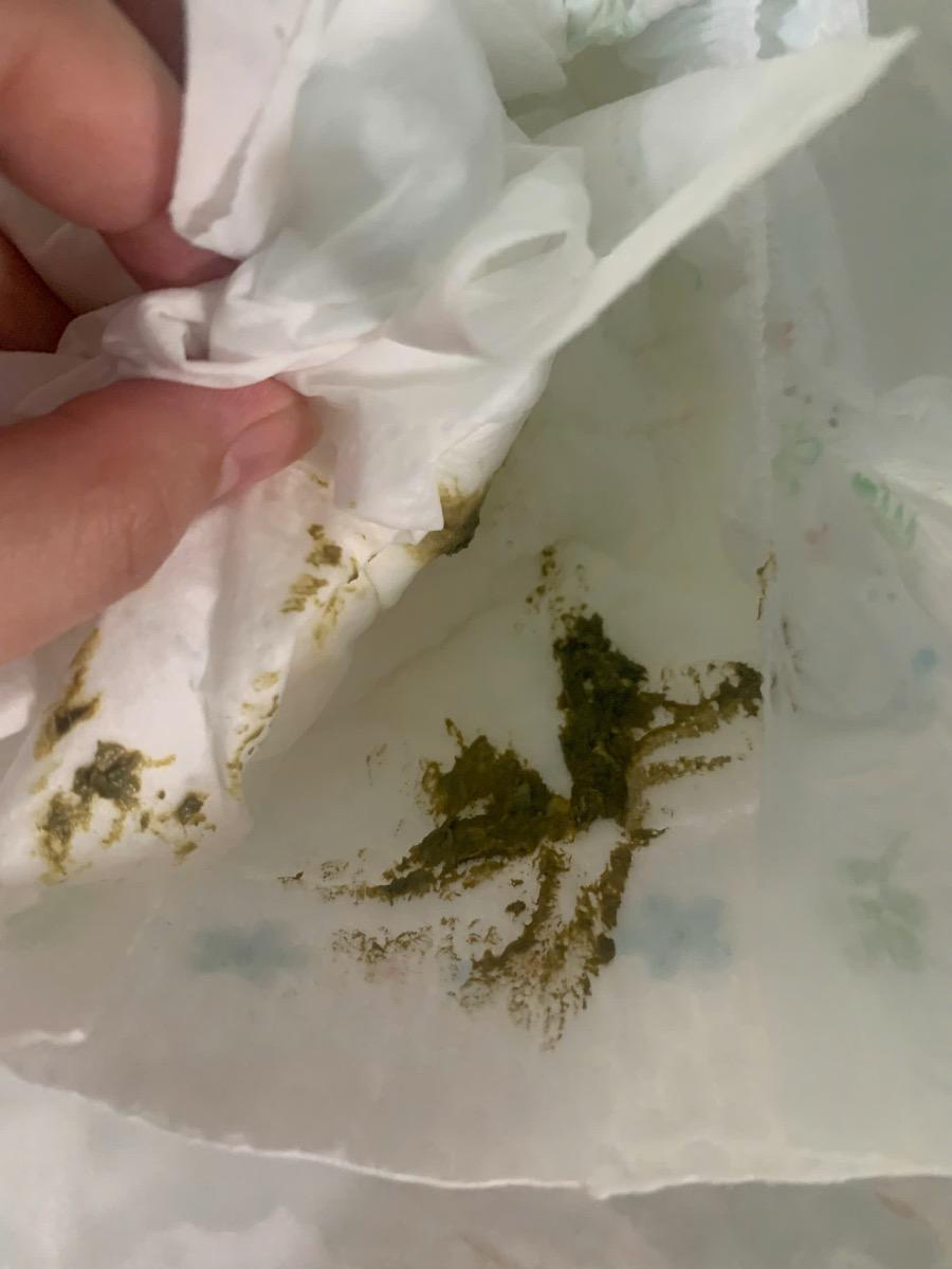 Bé nhà em 3m23 ngày hiện tại vẫn chơi ngủ bình thường nhưng bé bú rất ít. Hiện tại có lúc 4-5 tiếng bé bú 70-90ml lâu lâu chỉ bú 60ml không biết tình trạng này có ảnh huưởng sức khoẻ của bé không. Nhờ mamibabi tư vấn em xin cảm.
Hiện tại bé có đang đi phân màu như hình nhờ xem giúp em với ạ