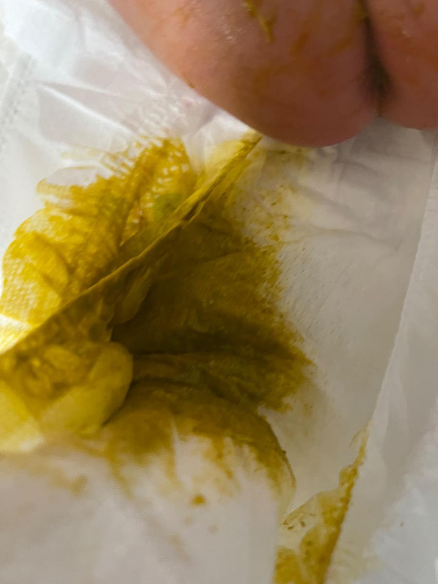 Bé em dc 1 tháng tuổi, dùng sữa mẹ, ngày bú 7 cữ, hiện khoảng 4 kg, hiện bé đi phân lỏng đã 4,5 ngày , trước đó em ăn chay em nghĩ do vậy nên bé dễ đi phân lỏng , tuy nhiên em chuyển qua ăn bt bé vẫn đi ngoài phân lỏng, em ko biết rõ nguyên nhân ạ, nhờ tư vấn giúp e ạ