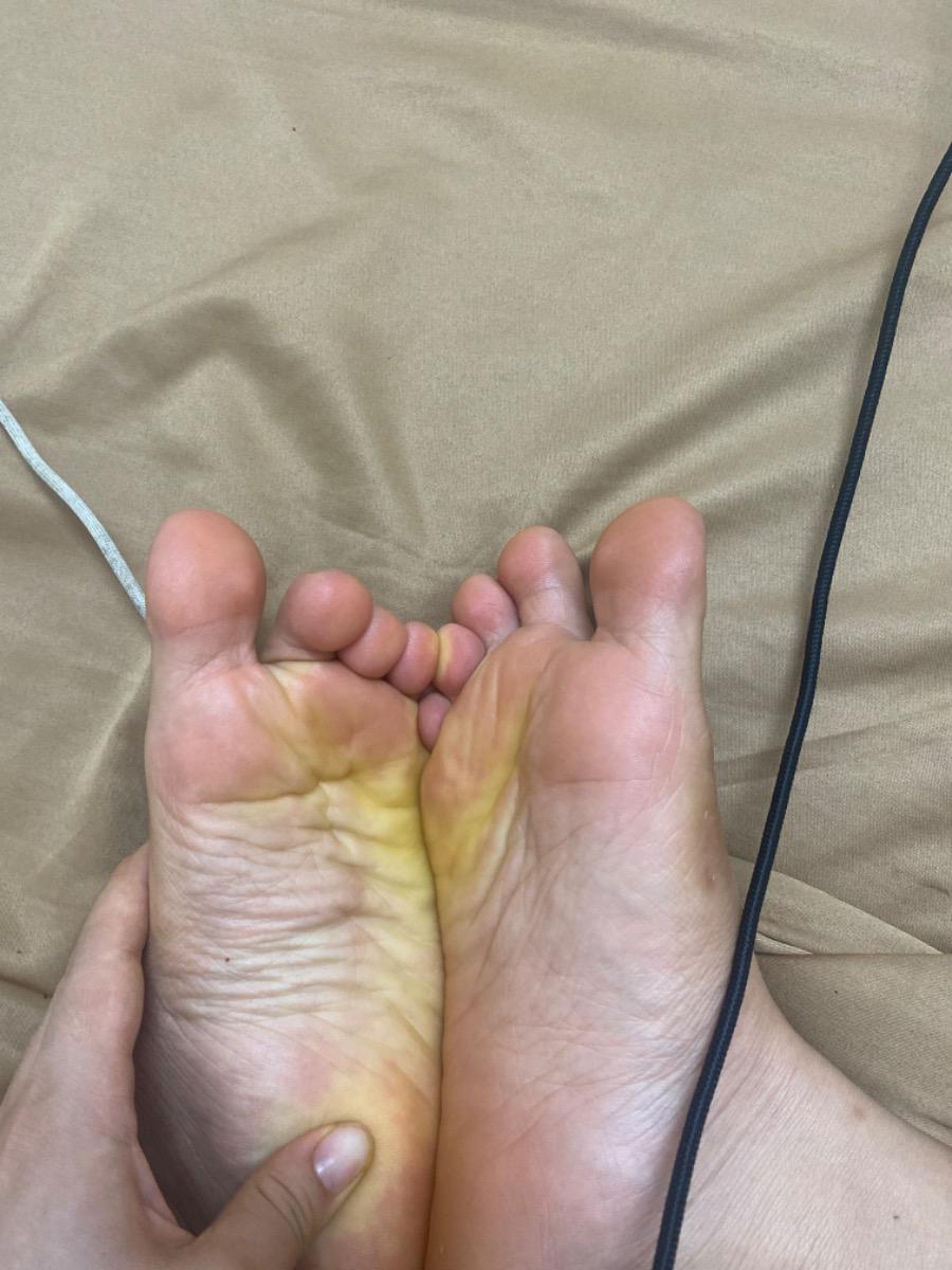 . Tự nhiên em thấy da vàng vàng quá. Hay chỉ là bình thường khi mang bầu thôi ạ