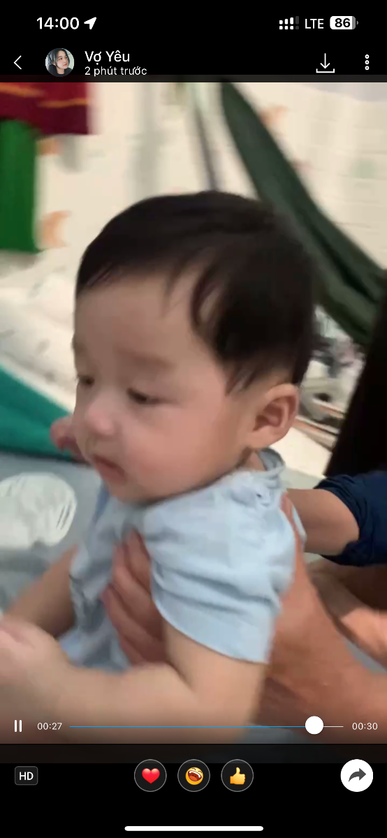 Hiện tại cháu được 5 tháng đầu cháu hơi nghiêng thì có phải bình thường ko. Nhờ mamibabi tư vấn hỗ trợ
Em cảm ơn
