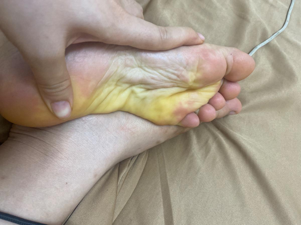 . Tự nhiên em thấy da vàng vàng quá. Hay chỉ là bình thường khi mang bầu thôi ạ