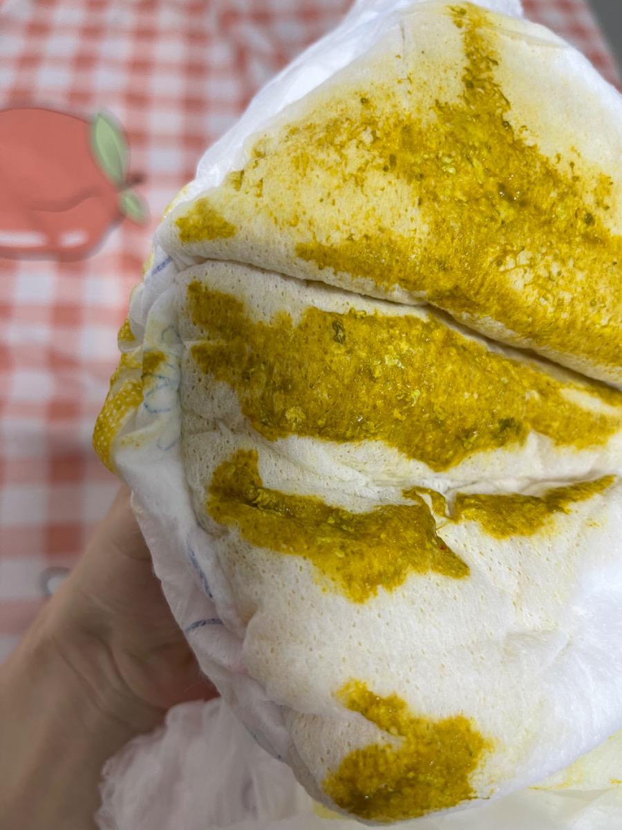 Chào bạn,
Bé nhà mình được 2 tháng. Mấy hôm nay bé đi phân lỏng 4-5 lần/ ngày. Phân vàng có dịch nhầy. Hôk nay bé đi phân hơi ngã xanh, có 1 vết máu đỏ nhỏ. Vậy bé mình bị rối loạn tiêu hoá hay như thế nào ạ. Và làm sao cải thiện? Có phải chế độ mẹ ăn đường nhiều ko ạ?