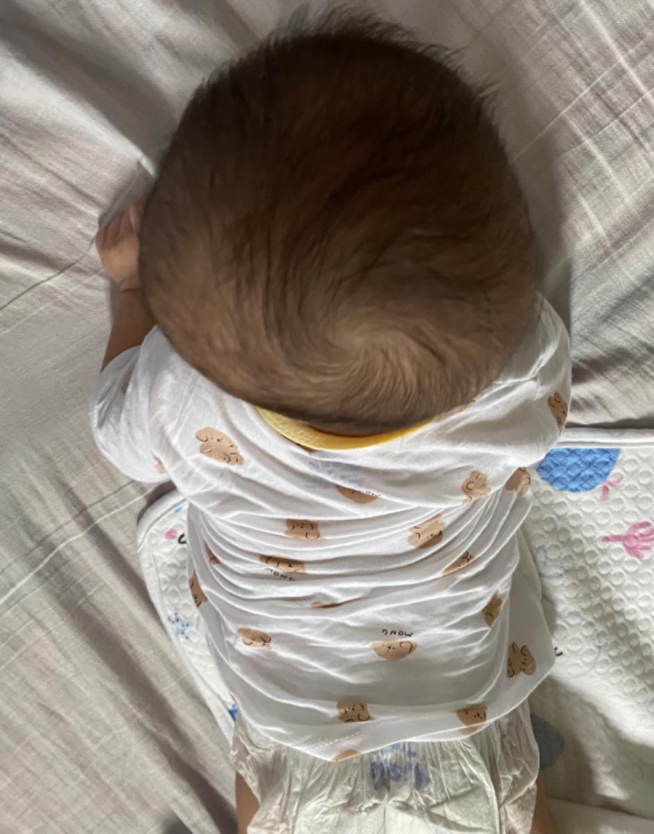 - Con e đang có tình trạng đầu phía sau như ảnh bên dưới, hình như bé bị bẹp đầu dưới thấy rõ luôn ạ. Bây giờ bé được 4 tháng rồi, thì làm sao để cải thiện tình trạng đầu của bé ạ, mặc dù bé cũng thường xuyên tự xoay và e cũng hỗ trợ nghiêng qua trái, qua phải cho bé trong lúc ngủ
- Khoảng 1 tuần gần đây, bé nhà e gặp thêm tình trạng là đôi khi vừa ăn xong là đi ngoài luôn, có khi phân xanh có khi phân vàng hơi lỏng ạ. Không biết là bị gì ạ, mong Mamibabi hỗ trợ tư vấn giúp em nhé 
Em cảm ơn ạ