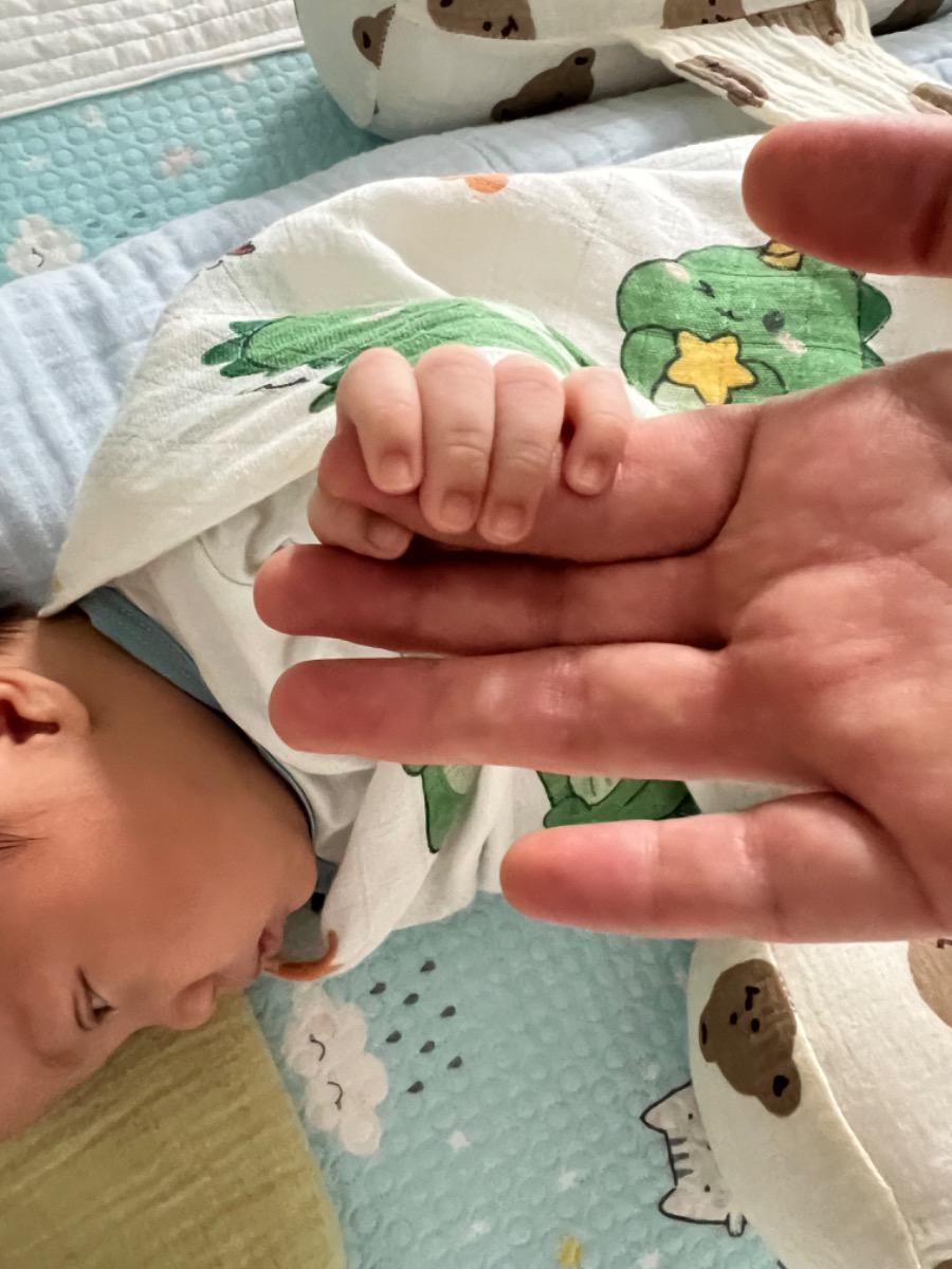 Tay con mình bị bàm nâu ở các đầu ngon tay như hình ở dưới thì có sao k ạ, bác sĩ tư vấn mình với ạ
