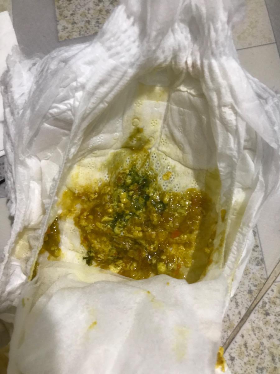 Bé 1 tuổi bị đau bụng, tiêu chảy ra phân như này có sao không ạ. Cả ngày bé chỉ ăn cháo khoai tây cà rốt thịt bằm với uống sữa thôi ạ.