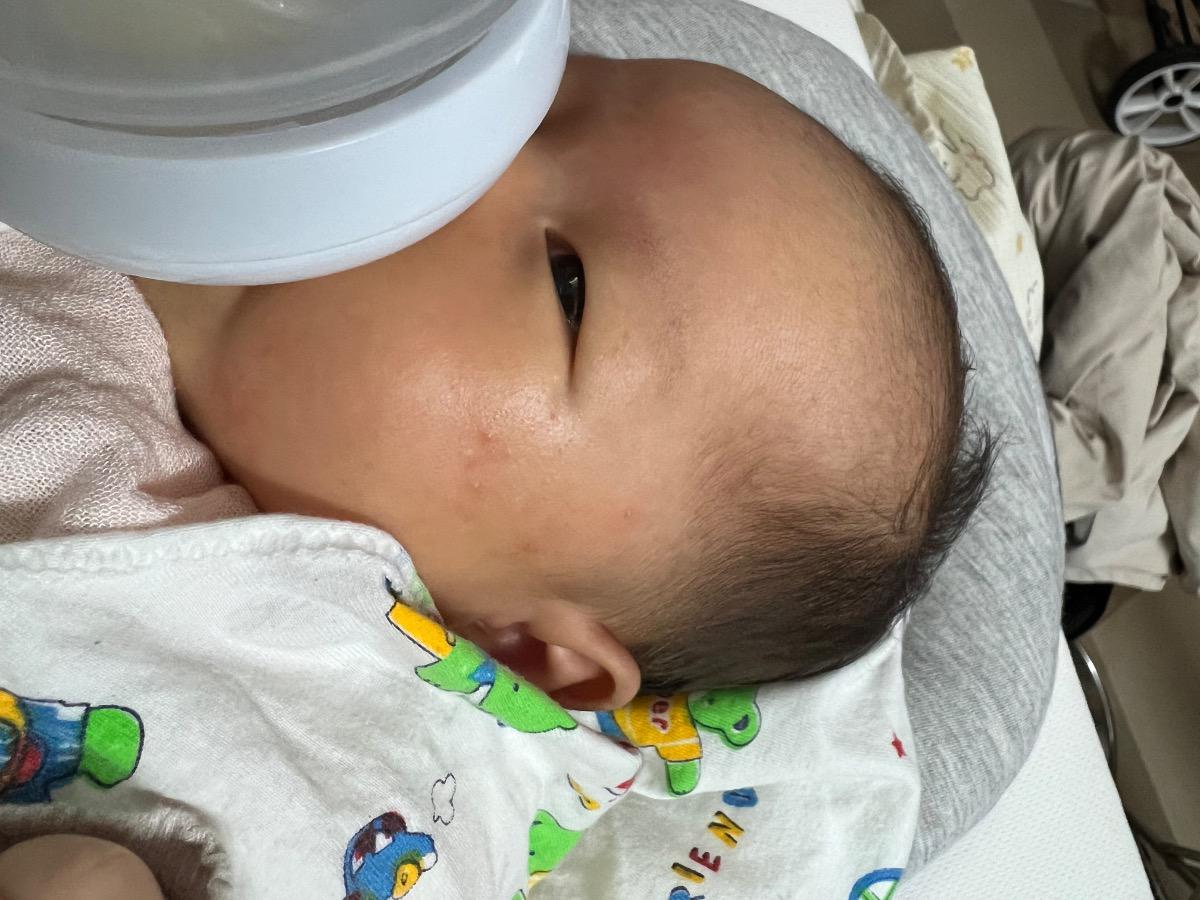 Em bé 1 tháng tuổi hôm nay em thấy trên mặt con có nhiều chấm đỏ li ti, cho em hỏi bé bị làm sao và có cách nào khắc phục không ạ