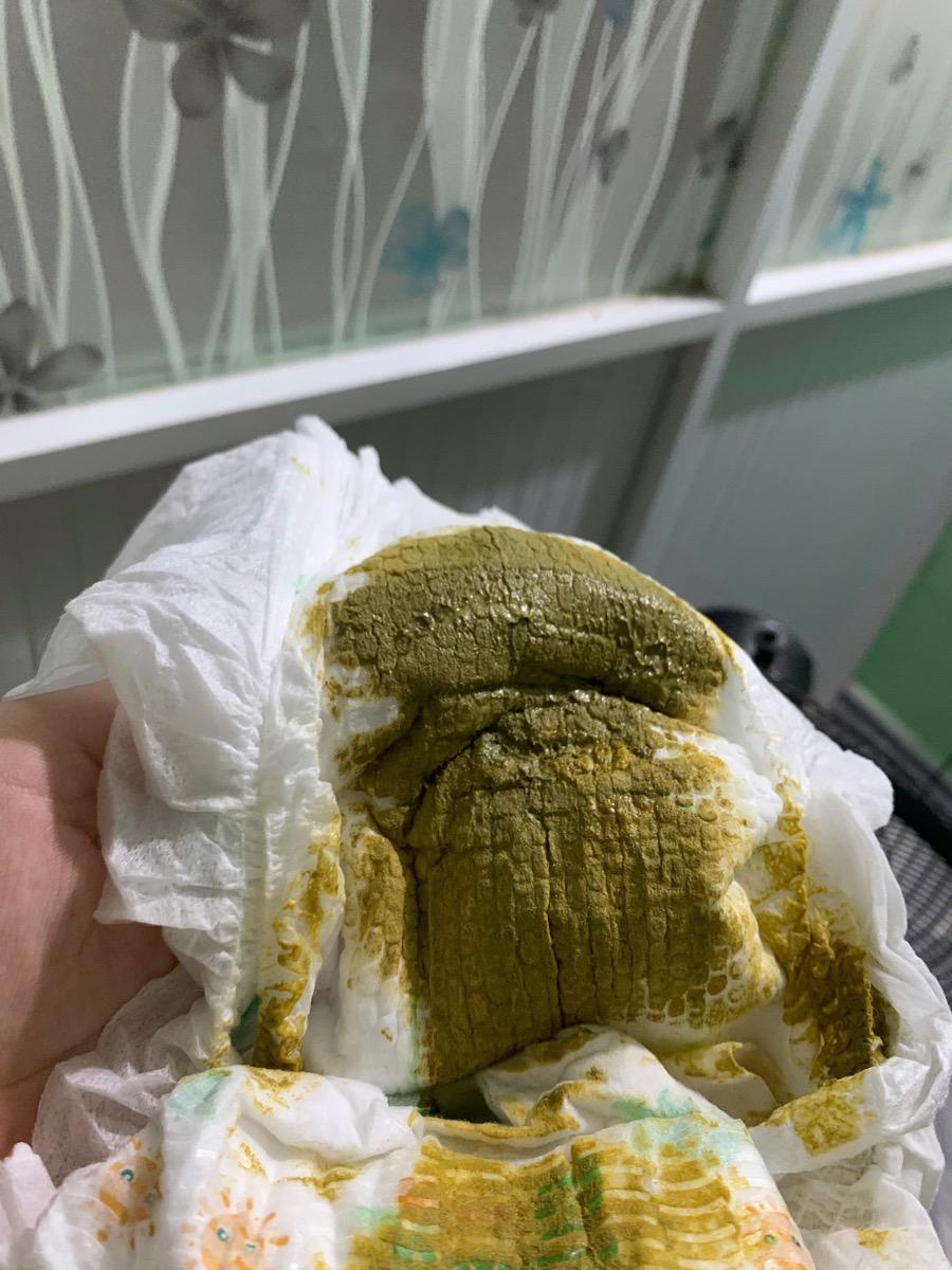 Hnay bé mình đi phân màu xanh như hình, ko nhầy ko nước nhưng rất hôi . mình ko biết có sao ko, bth bé đi phân vàng . Mẹ đang cho bé uống 2 cữ sct trên tổng 6 cữ. Ngày bth ị 1-2l/ngày , có khi cách ngày ị 1l.