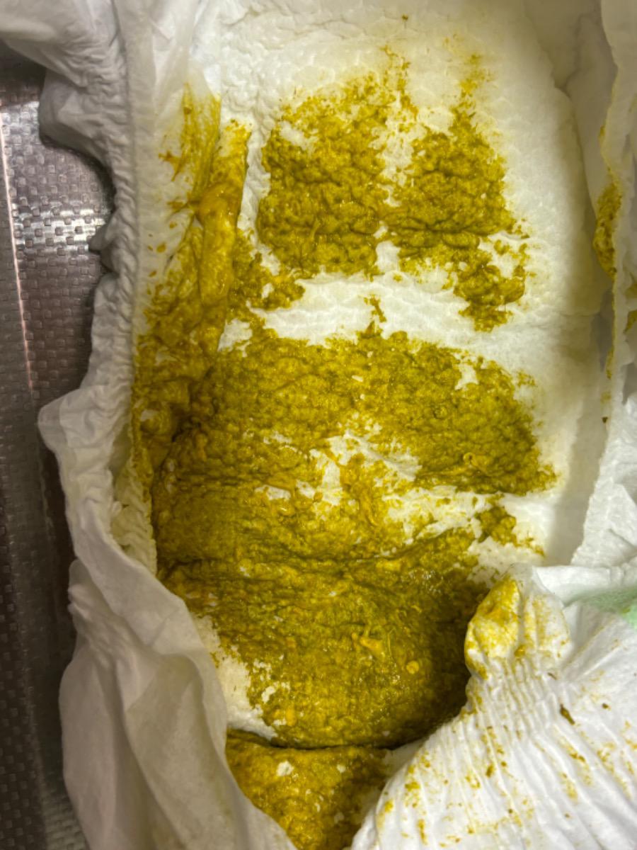 Bé  1th22d bé ti mẹ hoàn toàn thì đi phân như ảnh có bất thường k ạ.