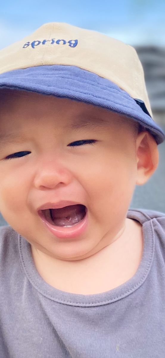 Có phải bé bị dính thắng lưỡi và phanh môi trên không ạ