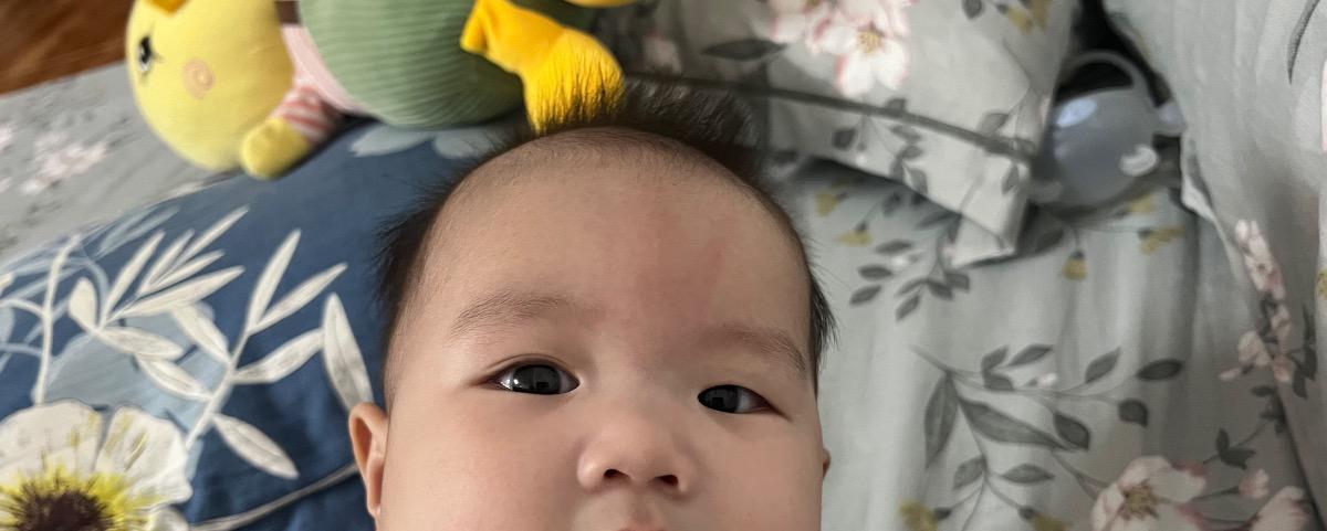 Bé chưa đc 6m tuổi, 1 bên lên mí còn 1 bên chưa lên, hồi mới sinh thì 2 mắt đều có giờ thì lại bên có bên không, xin hỏi chuyên gia vậy có bt ko ạ?
Với lại mắt bé vậy có phải bị lác hay ko ạ? Có cách nào để khắc phục tình trạng này ko ạ?