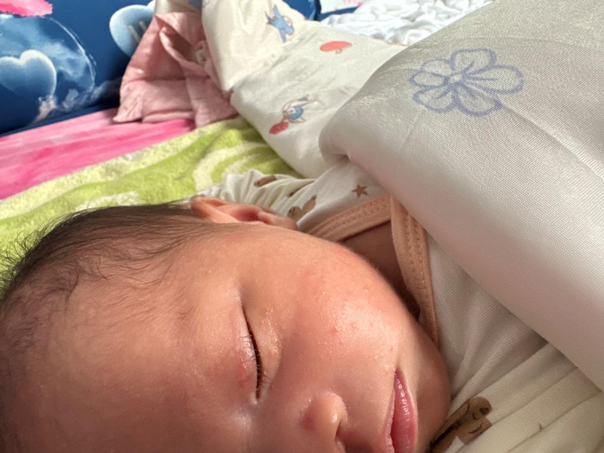 Xin cho hỏi cách xử lý mụn ở mặt và cổ của bé 20 ngày tuổi ạ , bé nổi mụn đỏ và trắng khắp mặt và cổ , có cách nào xử lý ko ạ ?