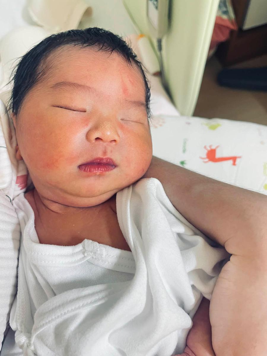 Hiện tại bé được 4 ngày tuổi có xuất hiện đốm trắng nhỏ li ti trên mũi . Làm sao để hết được ạ